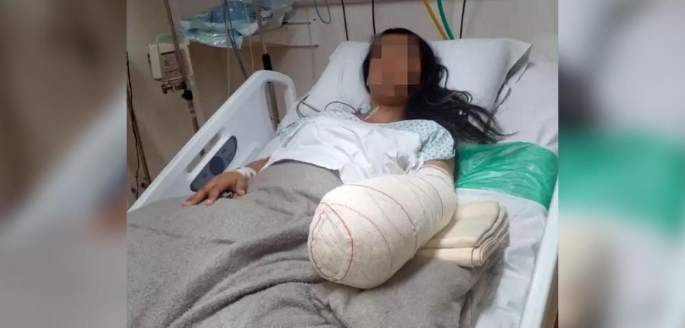 Mulher Vai Para Hospital Dar À Luz E Volta Com Mão E Punho Amputados.