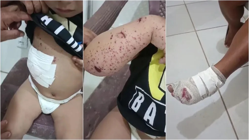Raio atinge casa e deixa três feridos no Ceará